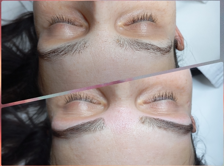 Rezultati laminacije trepalnic